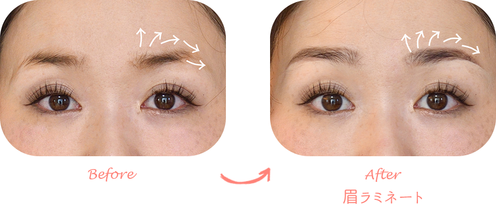 眉ラミネート（眉パーマ）変身例　女性の場合